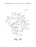 Customized Patient-Specific Multi-Cutting Blocks diagram and image