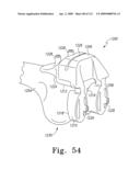 Customized Patient-Specific Multi-Cutting Blocks diagram and image