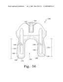 Customized Patient-Specific Multi-Cutting Blocks diagram and image