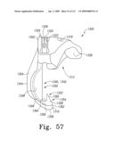 Customized Patient-Specific Multi-Cutting Blocks diagram and image