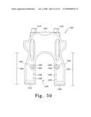 Customized Patient-Specific Multi-Cutting Blocks diagram and image