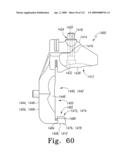 Customized Patient-Specific Multi-Cutting Blocks diagram and image