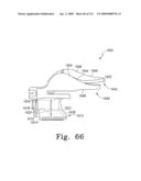 Customized Patient-Specific Multi-Cutting Blocks diagram and image