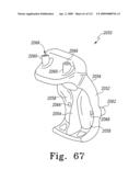 Customized Patient-Specific Multi-Cutting Blocks diagram and image