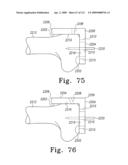 Customized Patient-Specific Multi-Cutting Blocks diagram and image