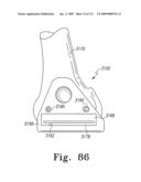 Customized Patient-Specific Multi-Cutting Blocks diagram and image