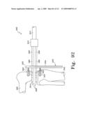 Customized Patient-Specific Multi-Cutting Blocks diagram and image