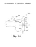 Customized Patient-Specific Multi-Cutting Blocks diagram and image