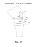 Customized Patient-Specific Multi-Cutting Blocks diagram and image