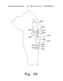 Customized Patient-Specific Multi-Cutting Blocks diagram and image