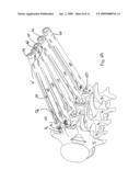 DUAL PIVOT INSTRUMENT FOR REDUCTION OF A FIXATION ELEMENT AND METHOD OF USE diagram and image