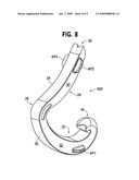 Non-snag polymer ligating clip diagram and image