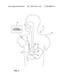 GASTRIC ELECTRICAL STIMULATION WITH LOCKOUT INTERVAL ANTI-DESENSITIZATION FEATURE diagram and image