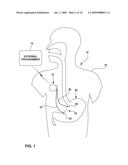 GASTRIC ELECTRICAL STIMULATION WITH MULTI-SITE STIMULATION ANTI-DESENSITIZATION FEATURE diagram and image