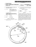 ADJUSTABLE ANNULOPLASTY RING AND ACTIVATION SYSTEM diagram and image