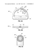 ADJUSTABLE ANNULOPLASTY RING AND ACTIVATION SYSTEM diagram and image