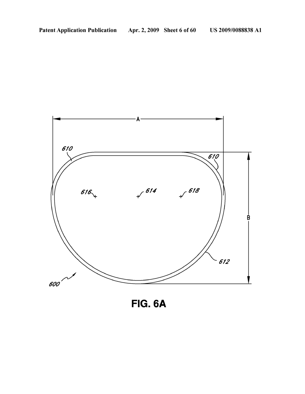 ADJUSTABLE ANNULOPLASTY RING AND ACTIVATION SYSTEM - diagram, schematic, and image 07