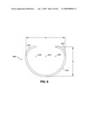 ADJUSTABLE ANNULOPLASTY RING AND ACTIVATION SYSTEM diagram and image