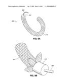 ADJUSTABLE ANNULOPLASTY RING AND ACTIVATION SYSTEM diagram and image