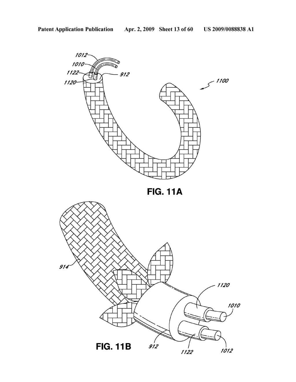 ADJUSTABLE ANNULOPLASTY RING AND ACTIVATION SYSTEM - diagram, schematic, and image 14