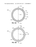 ADJUSTABLE ANNULOPLASTY RING AND ACTIVATION SYSTEM diagram and image