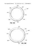 ADJUSTABLE ANNULOPLASTY RING AND ACTIVATION SYSTEM diagram and image