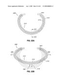 ADJUSTABLE ANNULOPLASTY RING AND ACTIVATION SYSTEM diagram and image