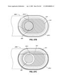 ADJUSTABLE ANNULOPLASTY RING AND ACTIVATION SYSTEM diagram and image