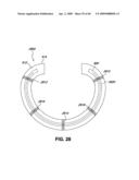 ADJUSTABLE ANNULOPLASTY RING AND ACTIVATION SYSTEM diagram and image