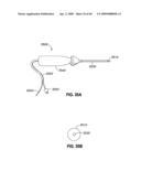 ADJUSTABLE ANNULOPLASTY RING AND ACTIVATION SYSTEM diagram and image