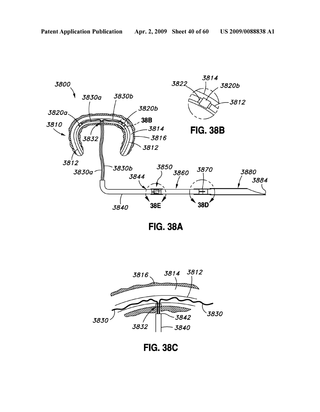 ADJUSTABLE ANNULOPLASTY RING AND ACTIVATION SYSTEM - diagram, schematic, and image 41