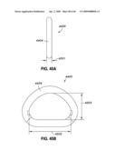 ADJUSTABLE ANNULOPLASTY RING AND ACTIVATION SYSTEM diagram and image