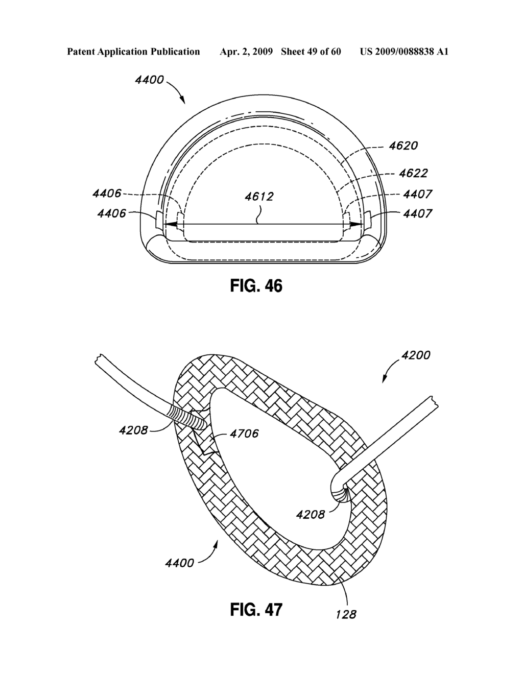 ADJUSTABLE ANNULOPLASTY RING AND ACTIVATION SYSTEM - diagram, schematic, and image 50