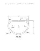 ADJUSTABLE ANNULOPLASTY RING AND ACTIVATION SYSTEM diagram and image