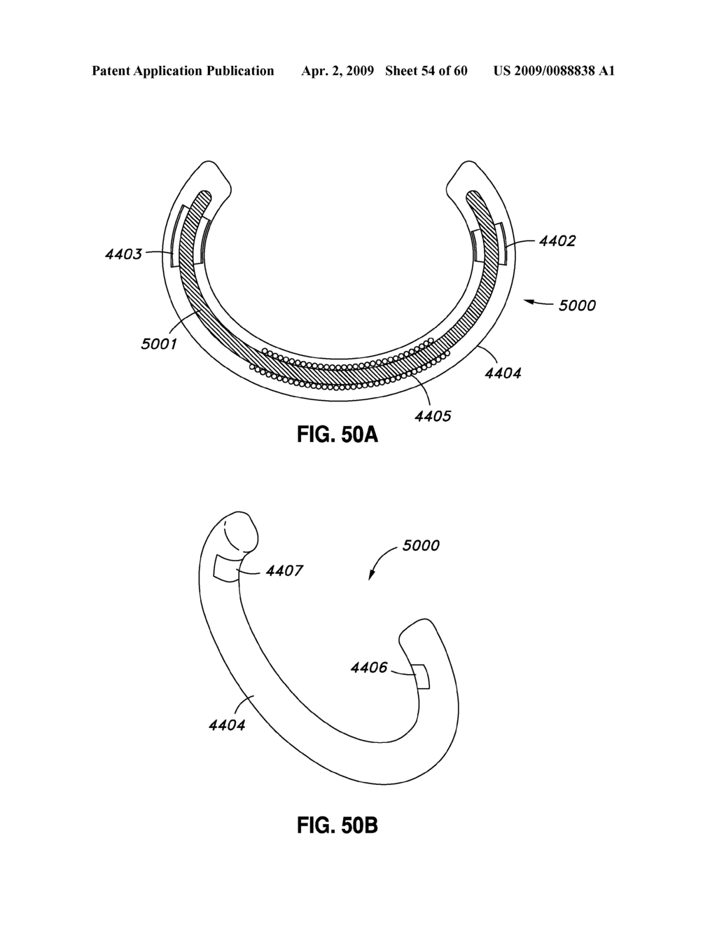 ADJUSTABLE ANNULOPLASTY RING AND ACTIVATION SYSTEM - diagram, schematic, and image 55