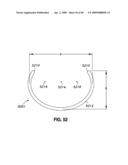 ADJUSTABLE ANNULOPLASTY RING AND ACTIVATION SYSTEM diagram and image