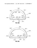 ADJUSTABLE ANNULOPLASTY RING AND ACTIVATION SYSTEM diagram and image