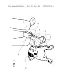 Animal Urine Specimen Collector diagram and image