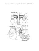 VARIABLY CONTROLLED ADJUSTABLE HEIGHT CARRIAGES FOR RAISING, LOWERING, HOLDING, LOCKING AND RELEASING OBJECTS ON ELEVATED STRUCTURES diagram and image