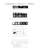 System and Method for Robust Segmentation of Pulmonary Nodules of Various Densities diagram and image