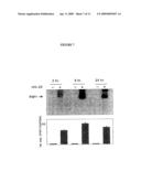 Interleukin-22 polypeptides, nucleic acids encoding the same and methods for the treatment of pancreatic disorders diagram and image