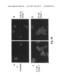 Method for treating cancer diagram and image