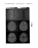 Noise reduction system and methods for magnetic resonance imaging diagram and image