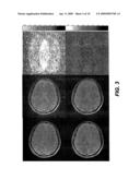 Noise reduction system and methods for magnetic resonance imaging diagram and image