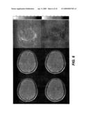 Noise reduction system and methods for magnetic resonance imaging diagram and image