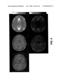 Noise reduction system and methods for magnetic resonance imaging diagram and image