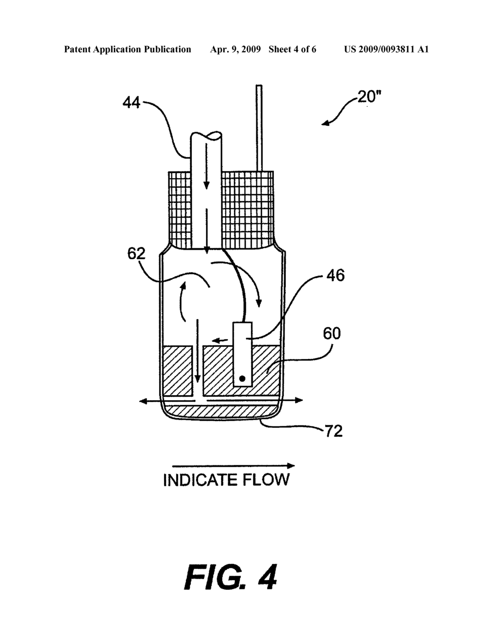 COOLED ABLATION CATHETER DEVICES AND METHODS OF USE - diagram, schematic, and image 05