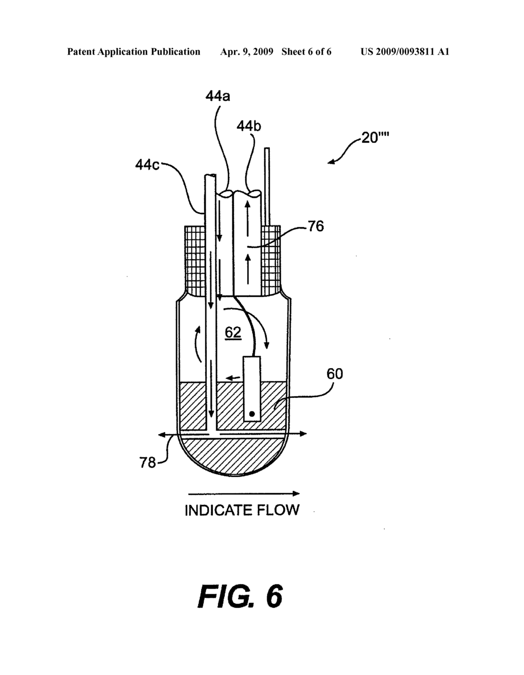 COOLED ABLATION CATHETER DEVICES AND METHODS OF USE - diagram, schematic, and image 07