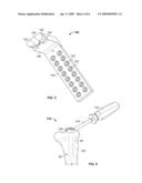 ALIGNMENT DEVICE FOR LOCKING NAIL diagram and image