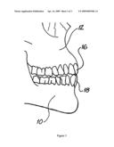 ORAL DEVICE FOR INTUBATION diagram and image